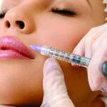Lip Filler in Tysons Corner