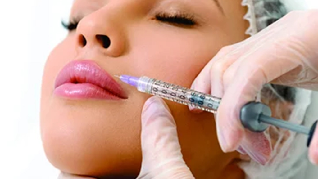 Lip Filler in Tysons Corner