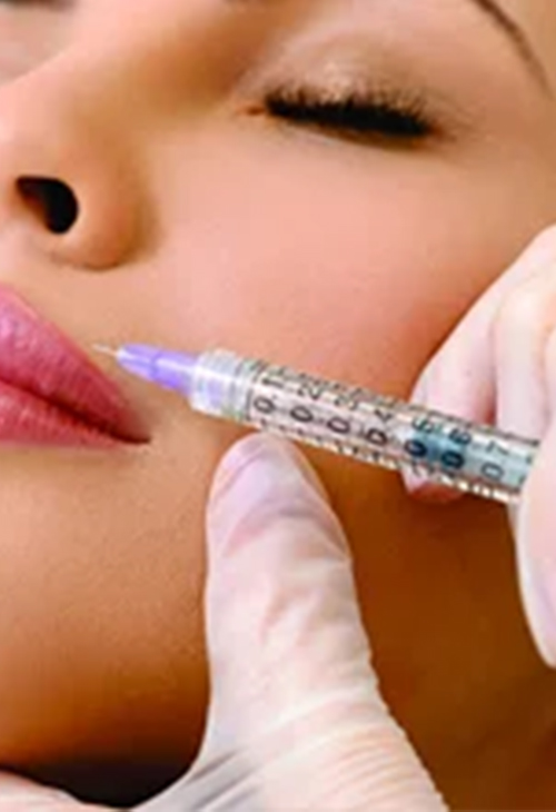 Dermal-fillers