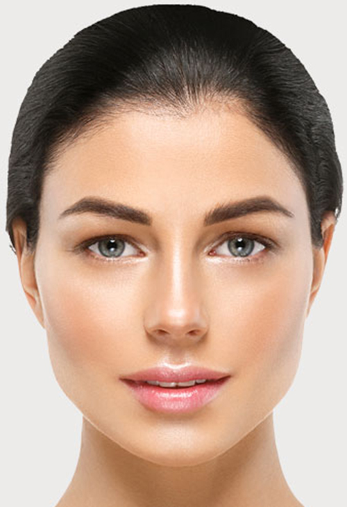 Exceed-Microneedling