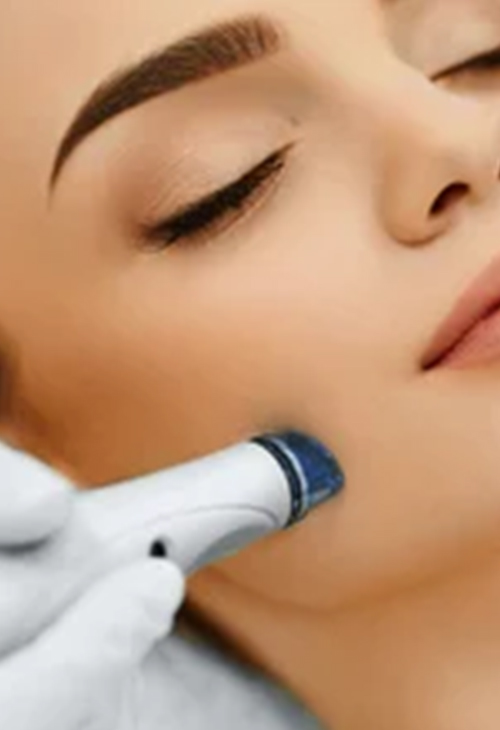 Laser-Skin-Rejuvenation